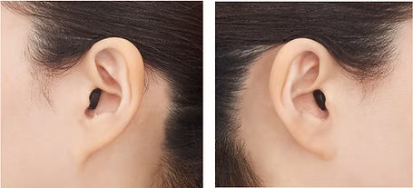 フェイスプレート