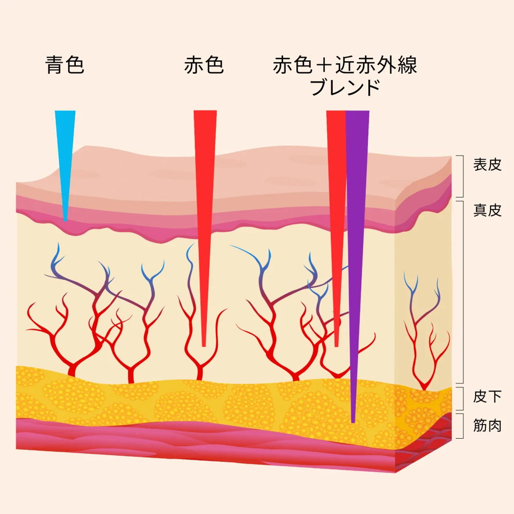 アプローチ