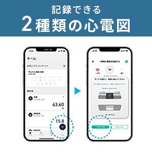 記録できる2種類の心電図