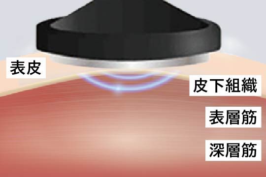 温感目もとケア